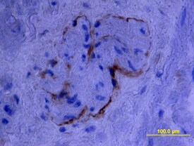 Endoglin/CD105 antibody in Human Prostate by Immunohistochemistry (IHC-P).