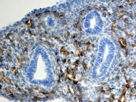 Endoglin/CD105 antibody in Mouse Lung by Immunohistochemistry (IHC-Fr).
