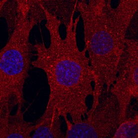 Endoglin/CD105 antibody in Mouse Mesenchymal Stem Cells by Immunocytochemistry (ICC).