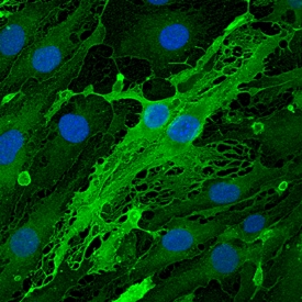 Endomucin antibody in bEnd by Immunocytochemistry (ICC).3 Mouse Cell Line by Immunocytochemistry (ICC).