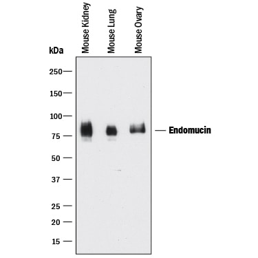 Detection of Mouse Endomucin antibody by Western Blot.