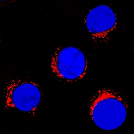 Endophilin B1/Bif-1 antibody in Jurkat Human Cell Line by Immunocytochemistry (ICC).