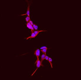 Endosialin/CD248 antibody in IMR-32 Human Cell Line by Immunocytochemistry (ICC).