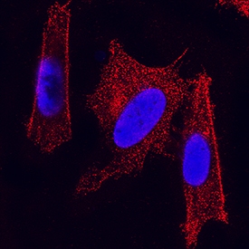 Enolase 2/Neuron-specific Enolase antibody in SH-SY5Y Human Cell Line by Immunocytochemistry (ICC).