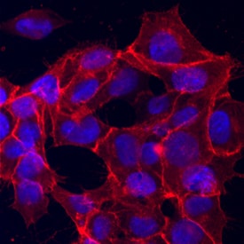 EpCAM/TROP-1 antibody in BG01V Human Embryonic Stem Cells by Immunocytochemistry (ICC).