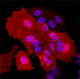EphA5 antibody in MCF-7 Human Cell Line by Immunocytochemistry (ICC).