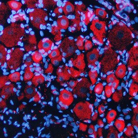 EphB1 antibody in Rat Brain by Immunohistochemistry (IHC-Fr).