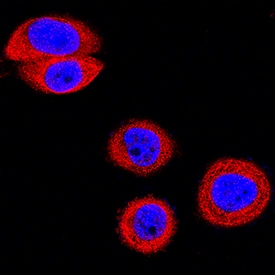 EphB2 antibody in MBA-MB-468 Human Cell Line by Immunocytochemistry (ICC).