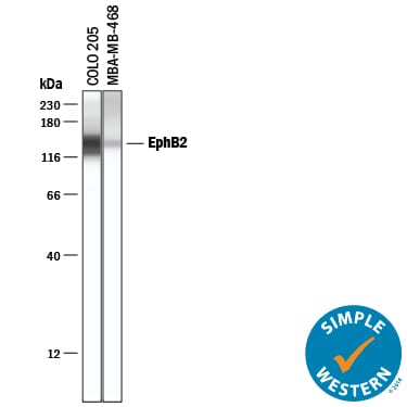 Detection of Human EphB2 antibody by Simple WesternTM.