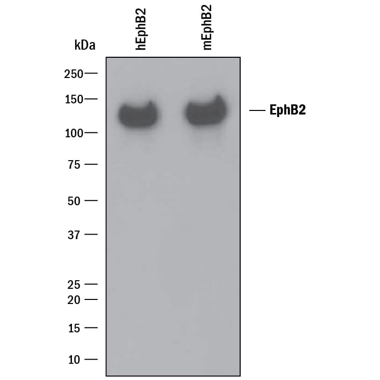 Detection of Recombinant Human and Mouse EphB2 antibody by Western Blot.