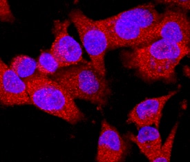 EphB2 antibody in MDA-MB-231 Human Cell Line by Immunocytochemistry (ICC).
