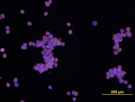 EphB3 antibody in COLO 205 Human Cell Line by Immunocytochemistry (ICC).