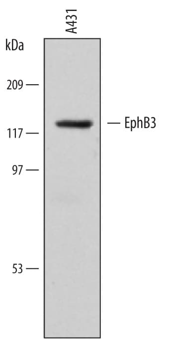 Detection of Human EphB3 antibody by Western Blot.
