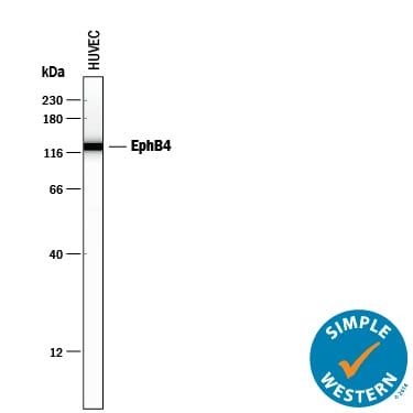 Detection of Human EphB4 antibody by Simple WesternTM.