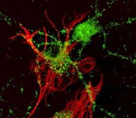 Ephrin‑A2 antibody in Rat Hippocampal Neurons by Immunocytochemistry (ICC).