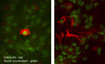 Ephrin-B2 antibody in Rat Hippo-campal Neurons by Immunocytochemistry (ICC).