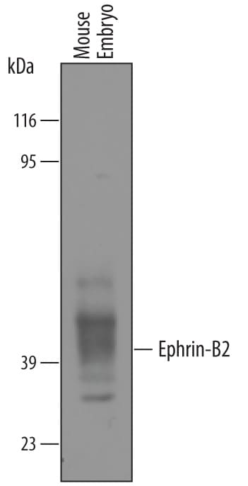 Detection of Mouse Ephrin‑B2 antibody by Western Blot.
