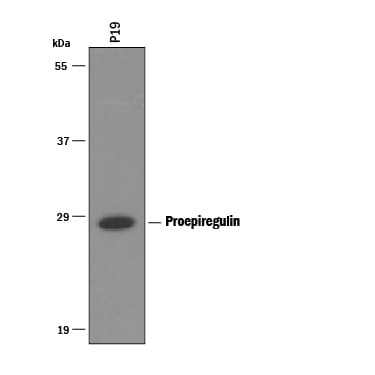 Detection of Mouse Epiregulin antibody by Western Blot.