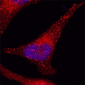 Eps15 antibody in HeLa Human Cell Line by Immunocytochemistry (ICC).