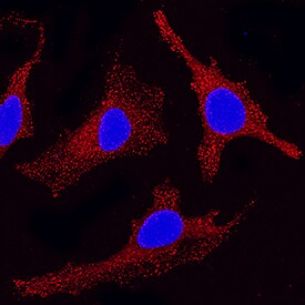 Eps15 antibody in HeLa Human Cell Line by Immunocytochemistry (ICC).