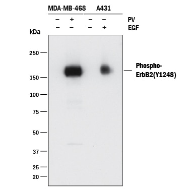 Detection of Human Phospho-ErbB2/Her2 (Y1248) antibody by Western Blot.