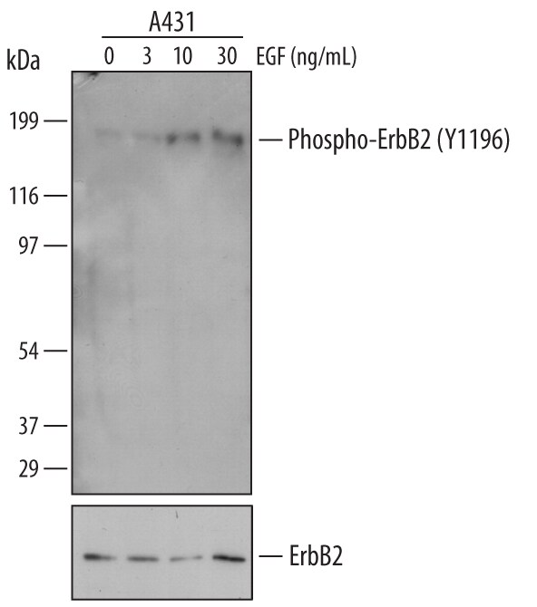 Detection of Human Phospho-ErbB2/Her2 (Y1196) antibody by Western Blot.