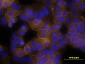 ErbB2/Her2 antibody in MCF-7 Human Cell Line by Immunocytochemistry (ICC).