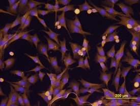 ErbB2/Her2 antibody in MDA-MB-231 Human Cell Line by Immunocytochemistry (ICC).