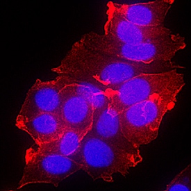 ErbB4/Her4 antibody in MCF-7 Human Cell Line by Immunocytochemistry (ICC).