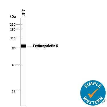 Detection of Human Erythropoietin R antibody by Simple WesternTM.