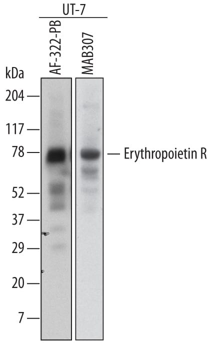 Detection of Human Erythropoietin R antibody by Western Blot.