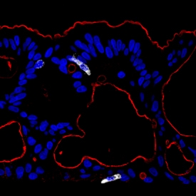 Ezrin antibody in Human Colon Stem Cells by Immunohistochemistry (IHC-P).