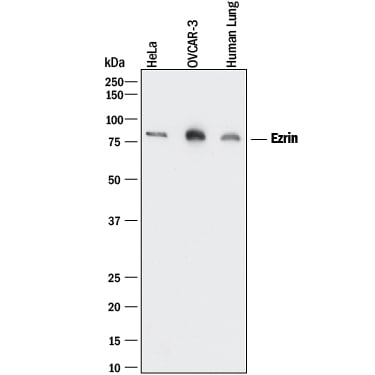 Detection of Human Ezrin antibody by Western Blot.