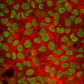 F-box protein 15/FBXO15 antibody in BG01V Human Embryonic Stem Cells by Immunocytochemistry (ICC).