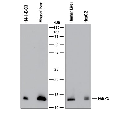 Detection of Human, Mouse, and Rat FABP1/L-FABP antibody by Western Blot.