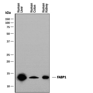 Detection of Human FABP1/L-FABP antibody by Western Blot.