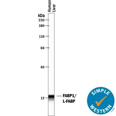 Detection of Human FABP1/L‑FABP antibody by Simple WesternTM.