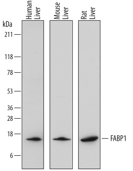 Detection of Human, Mouse, and Rat FABP1/ L-FABP antibody by Western Blot.