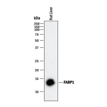 Detection of Rat FABP1/L-FABP antibody by Western Blot.