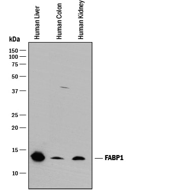 Detection of Human FABP1/L‑FABP antibody by Western Blot.