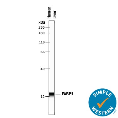 Detection of Human FABP1/L-FABP antibody by Simple WesternTM.