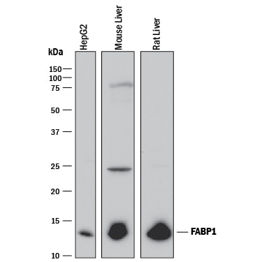 Detection of Human, Mouse, and Rat FABP1/L-FABP antibody by Western Blot.