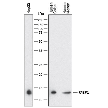 Detection of Human FABP1/L-FABP antibody by Western Blot.
