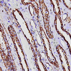 FABP1/L-FABP antibody in Human Kidney by Immunohistochemistry (IHC-P).