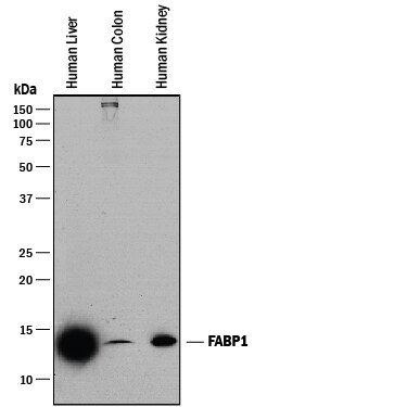 Detection of Human FABP1/L‑FABP antibody by Western Blot.