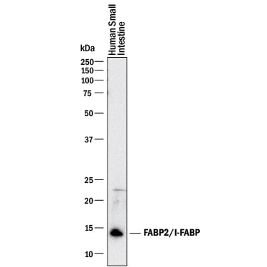 Detection of Human FABP2/I-FABP antibody by Western Blot.