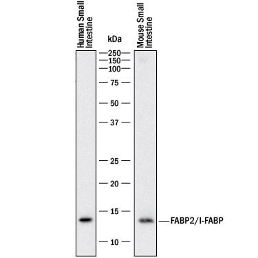Detection of Human and Mouse FABP2/I-FABP antibody by Western Blot.