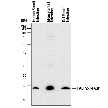 Detection of Human, Mouse, and Rat FABP2/I-FABP antibody by Western Blot.