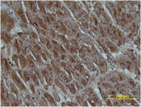 FABP3/H-FABP antibody in Human Heart by Immunohistochemistry (IHC-P).