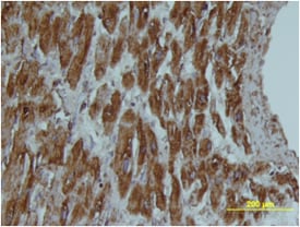 FABP3/H-FABP antibody in Human Heart by Immunohistochemistry (IHC-P).